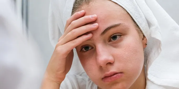 Как определить рак по лицу: 2 очевидных признака